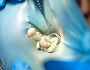 стоматолог_зуб