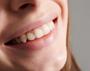Красивые зубы