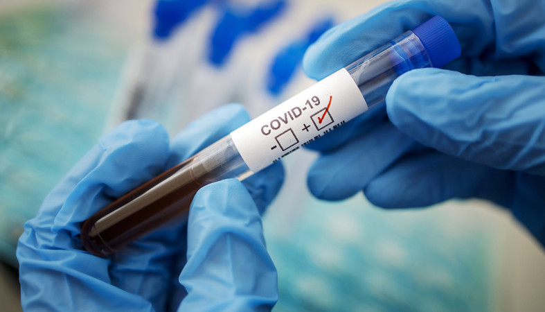 Около 100 человек заразились COVID-19 в Карелии