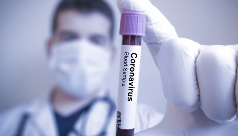 Почти два десятка новых случаев заражения COVID-19 выявлено в Карелии