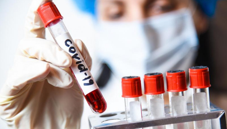 Более 350 новых случаев коронавируса выявлены в Карелии за сутки