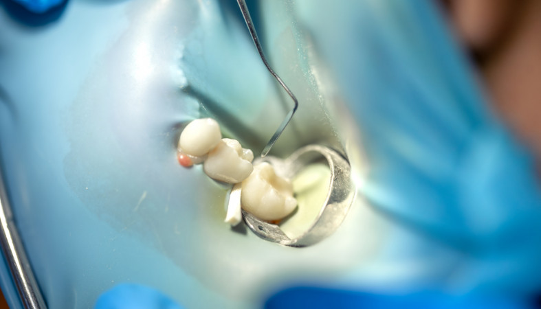 стоматолог_зуб