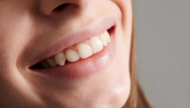 Красивые зубы Красивые зубы